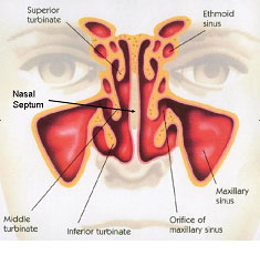 Septoplasty-at-ENT-Doctor-La