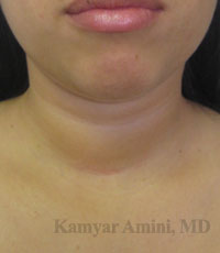 Thyroid-20sB.jpg