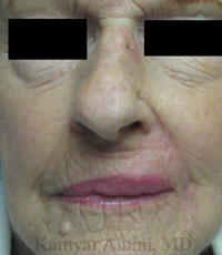 lip-large-4-B