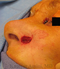 nostril2-B.jpg